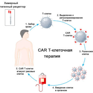 CAR-T-терапия-один из самых прогрессивных методов лечения рака